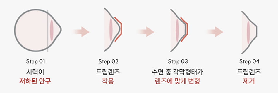 How Dream Lens Works