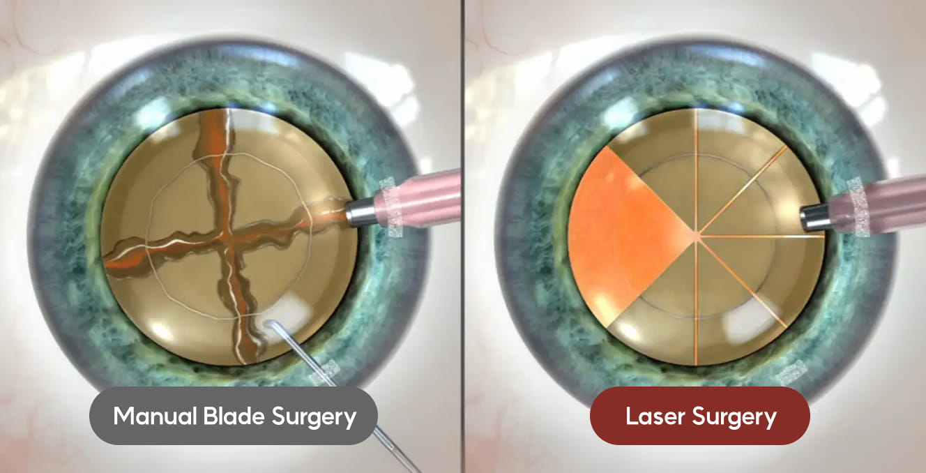 Precise Incision and Lens Fragmentation