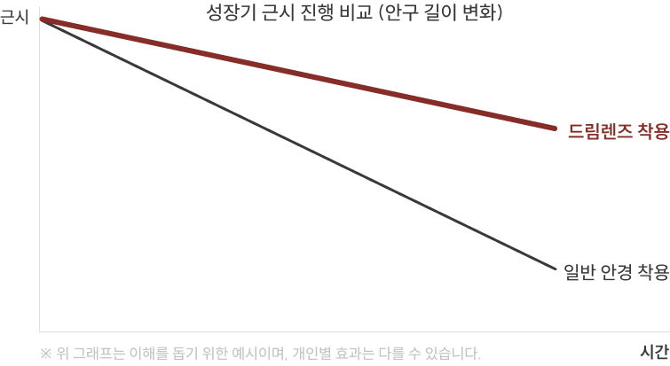 성장기 근시 진행 비교 (안구 길이 변화)