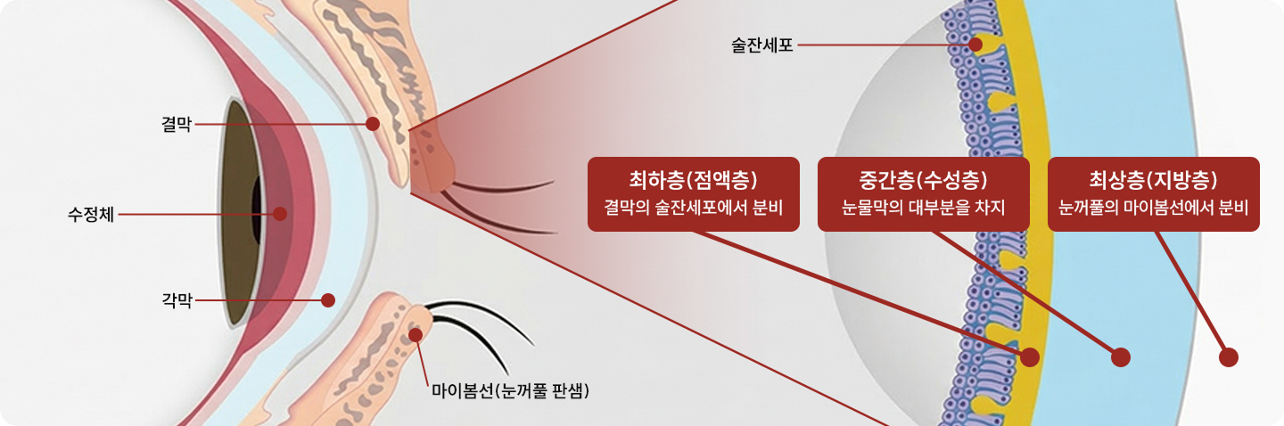 안구건조증 원인