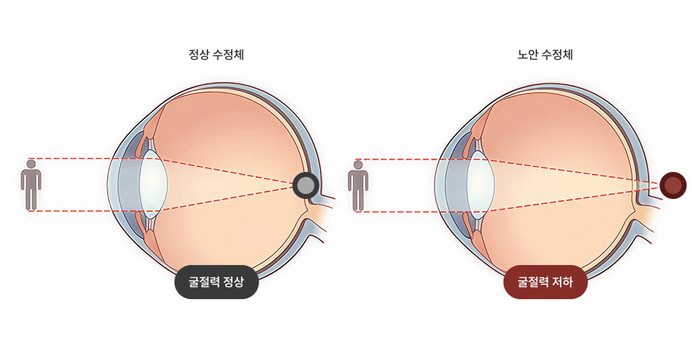 OOC 시스템 정밀 검사